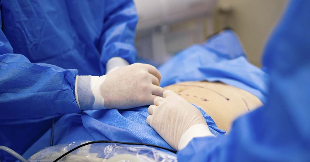 Cirurgia bariátrica é segura? Conheça os protocolos da técnica robótica