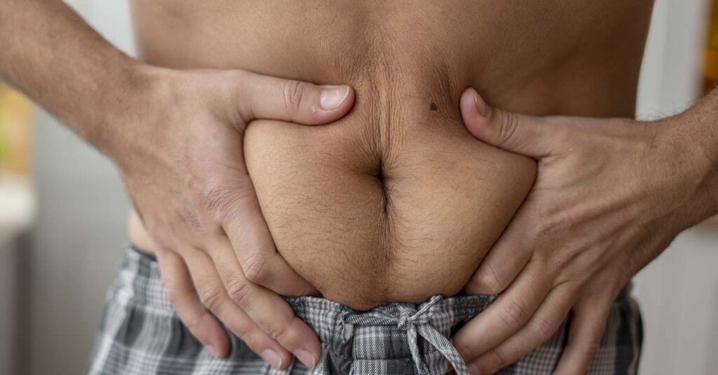 Diástase abdominal em homens: o que é, causas e quando tratar